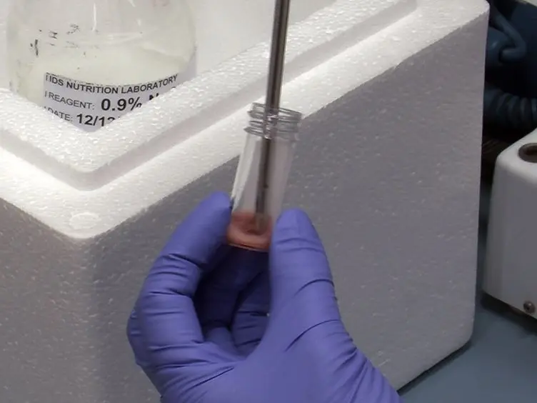 The Use of Gas Chromatography to Analyze Compositional Changes of Fatty Acids in Rat Liver Tissue during Pregnancy