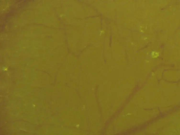 Two-Photon <em>in vivo</em> Imaging of Dendritic Spines in the Mouse Cortex Using a Thinned-skull Preparation