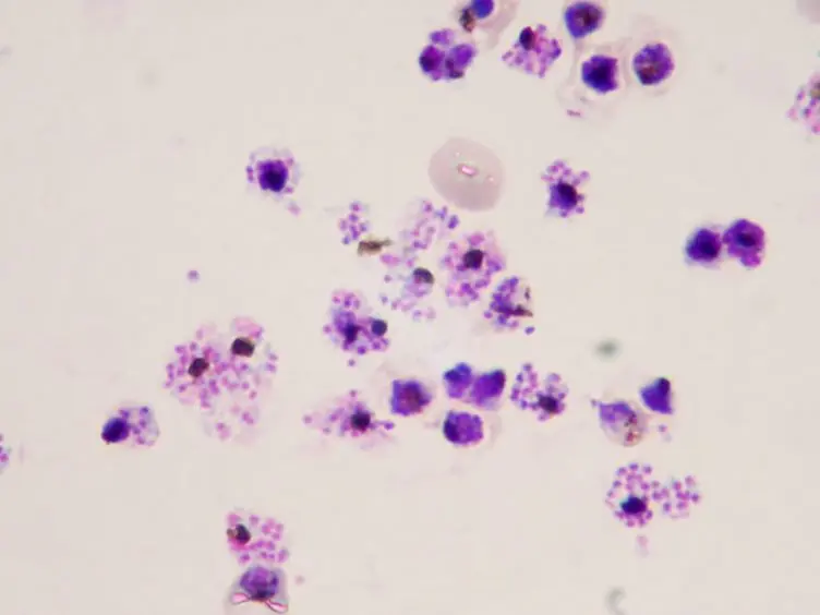 High Yield Purification of <em>Plasmodium falciparum</em> Merozoites For Use in Opsonizing Antibody Assays