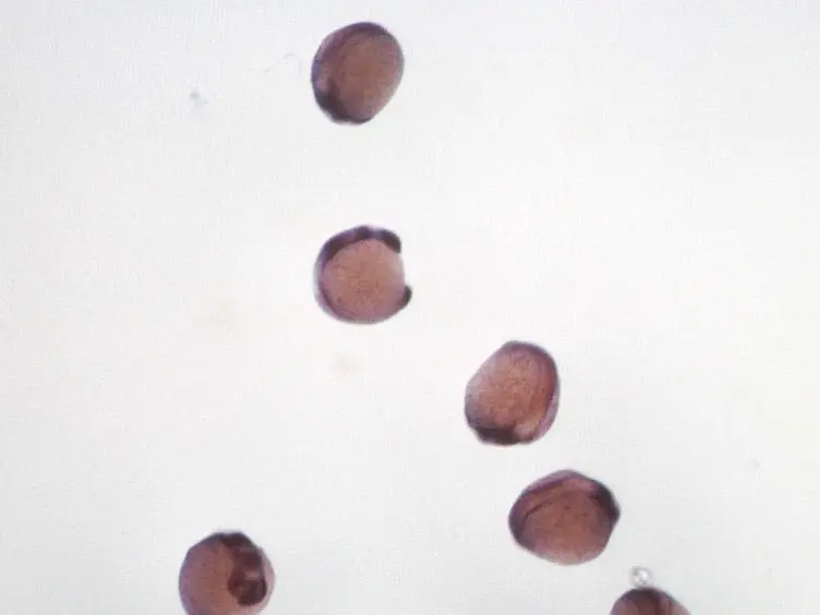 Flat Mount Preparation for Observation and Analysis of Zebrafish Embryo Specimens Stained by Whole Mount <em>In situ</em> Hybridization