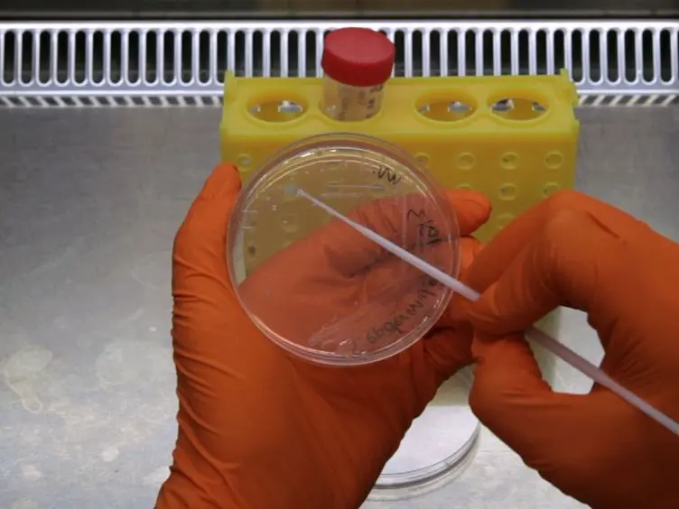 Establishment and Optimization of a High Throughput Setup to Study <em>Staphylococcus epidermidis</em> and <em>Mycobacterium marinum</em> Infection as a Model for Drug Discovery