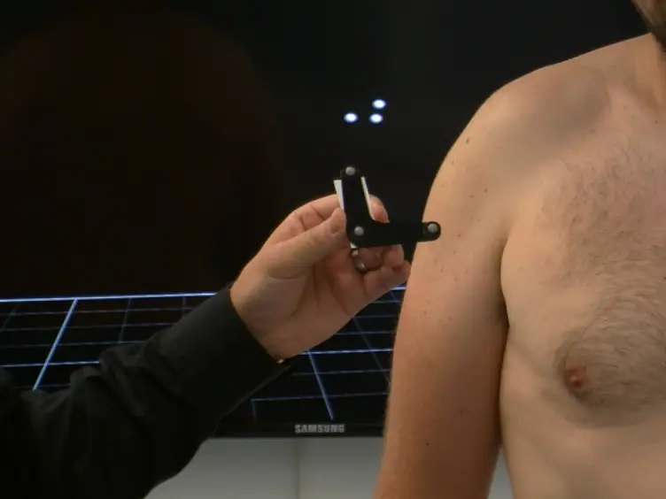 Measurement of Dynamic Scapular Kinematics Using an Acromion Marker Cluster to Minimize Skin Movement Artifact