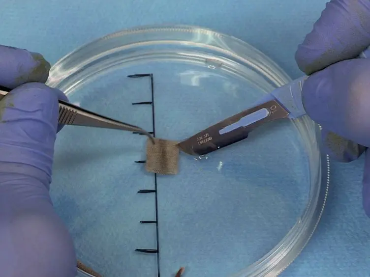 Transplantation of Tail Skin to Study Allogeneic CD4 T Cell Responses in Mice