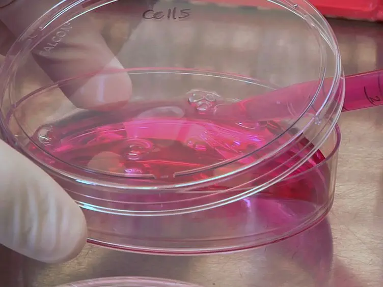 Focus Formation: A Cell-based Assay to Determine the Oncogenic Potential of a Gene