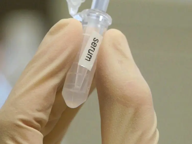 Hydrogel Nanoparticle Harvesting of Plasma or Urine for Detecting Low Abundance Proteins