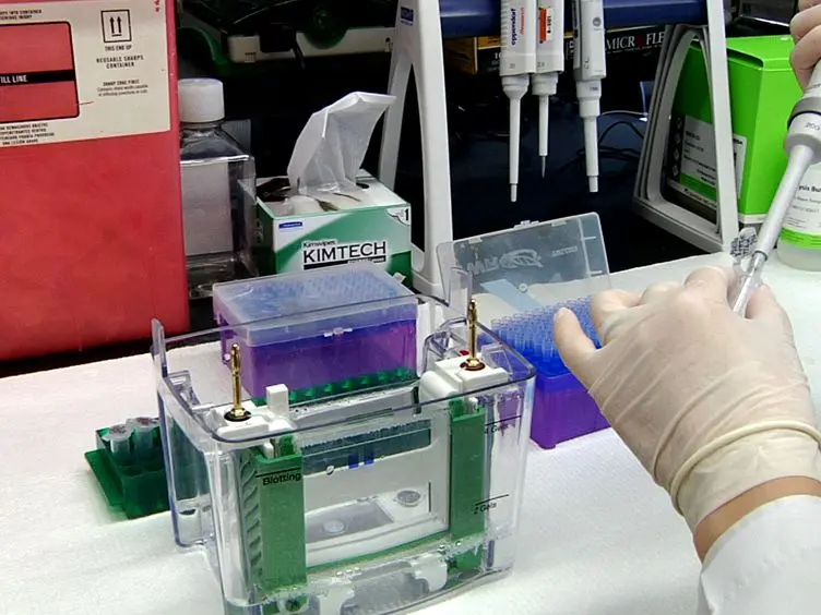 Detection of Alternative Splicing During Epithelial-Mesenchymal Transition
