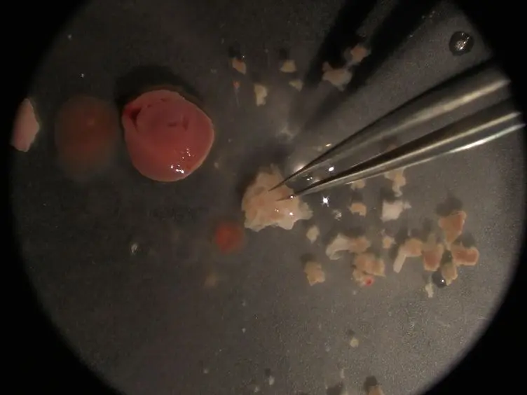 Isolation of Murine Valve Endothelial Cells