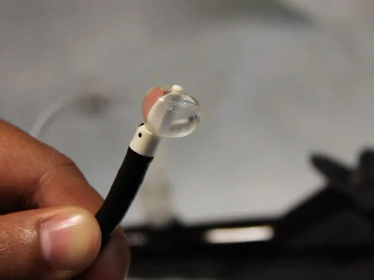 Substernal Thyroid Biopsy Using Endobronchial Ultrasound-guided Transbronchial Needle Aspiration