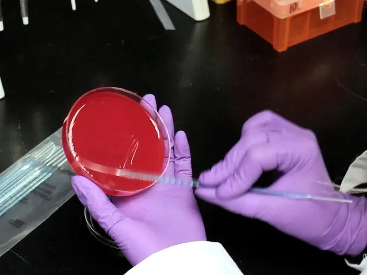Using the Overlay Assay to Qualitatively Measure Bacterial Production of and Sensitivity to Pneumococcal Bacteriocins