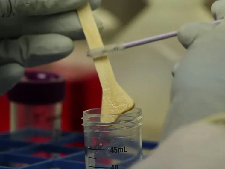 Collection, Isolation, and Flow Cytometric Analysis of Human Endocervical Samples