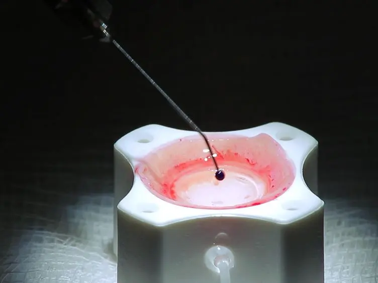 Corneal Donor Tissue Preparation for Descemet's Membrane Endothelial Keratoplasty
