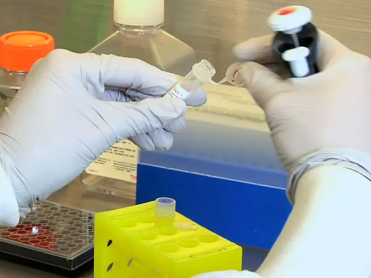 Real-time Cytotoxicity Assays in Human Whole Blood
