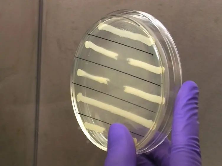 Non-Invasive Model of Neuropathogenic <em>Escherichia coli</em> Infection in the Neonatal Rat