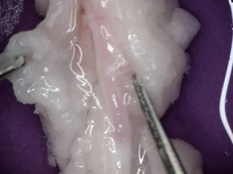 Isolating and Using Sections of Bovine Mesenteric Artery and Vein as a Bioassay to Test for Vasoactivity in the Small Intestine