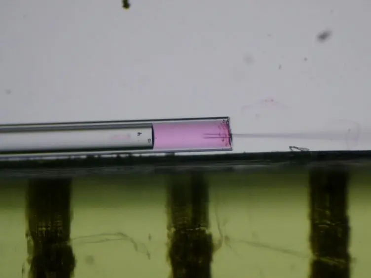 A Possible Zebrafish Model of Polycystic Kidney Disease: Knockdown of <em>wnt5a</em> Causes Cysts in Zebrafish Kidneys