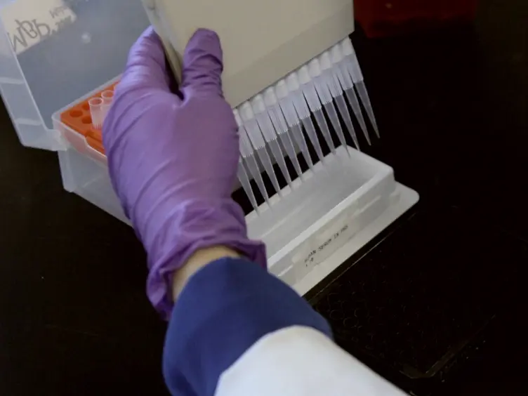 Detection of Human Leukocyte Antigen Biomarkers in Breast Cancer Utilizing Label-free Biosensor Technology