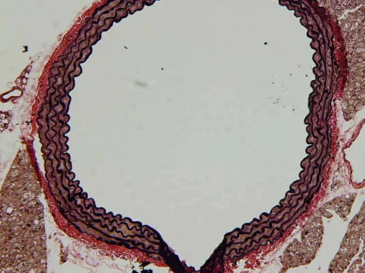 Isolation and Excision of Murine Aorta; A Versatile Technique in the Study of Cardiovascular Disease
