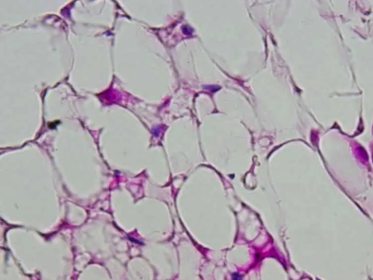 Localization, Identification, and Excision of Murine Adipose Depots