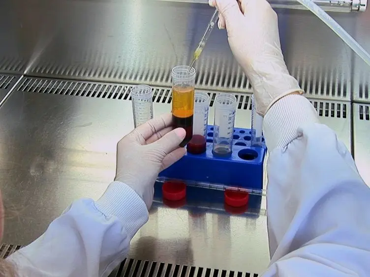 Proteomic Profiling of Macrophages by 2D Electrophoresis