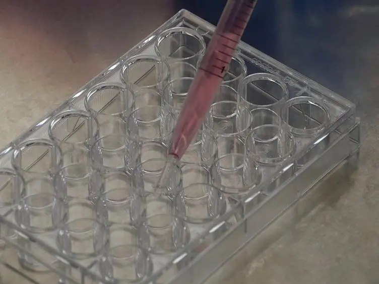 Direct Induction of Human Neural Stem Cells from Peripheral Blood Hematopoietic Progenitor Cells