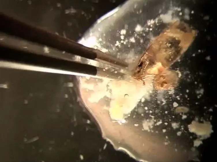 Dissection and Mounting of <em>Drosophila</em> Pupal Eye Discs