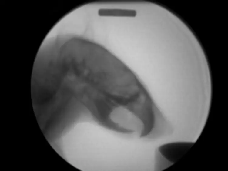 Adapting Human Videofluoroscopic Swallow Study Methods to Detect and Characterize Dysphagia in Murine Disease Models