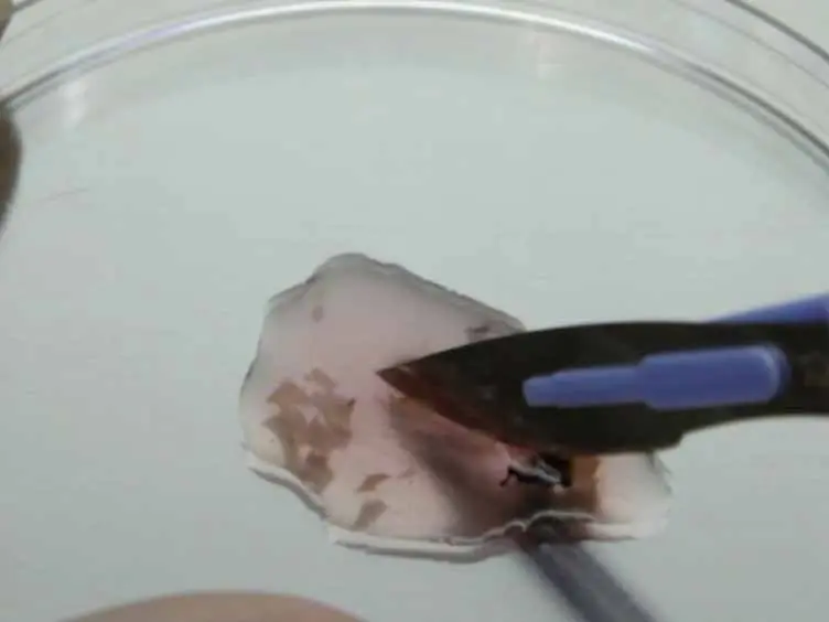A Simple and Rapid Protocol to Non-enzymatically Dissociate Fresh Human Tissues for the Analysis of Infiltrating Lymphocytes