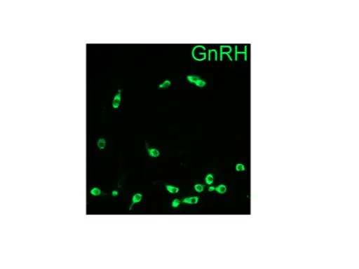 Conditional Genetic Transsynaptic Tracing in the Embryonic Mouse Brain