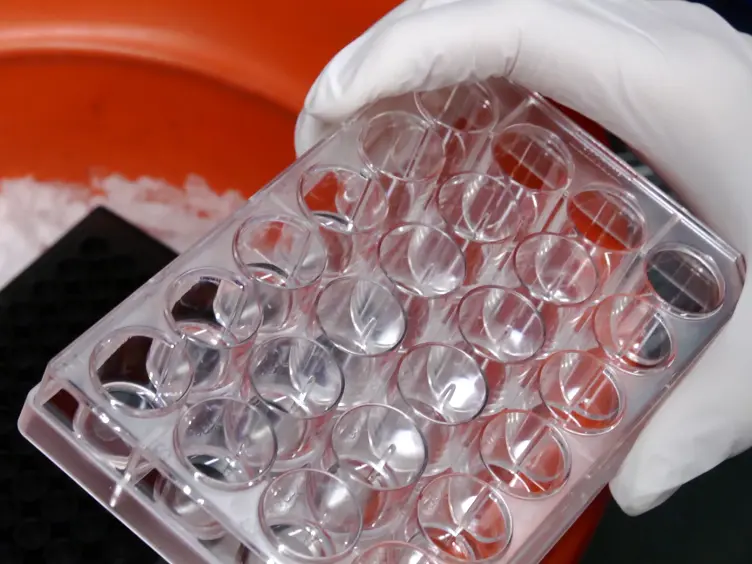 Investigating Mast Cell Secretory Granules; from Biosynthesis to Exocytosis