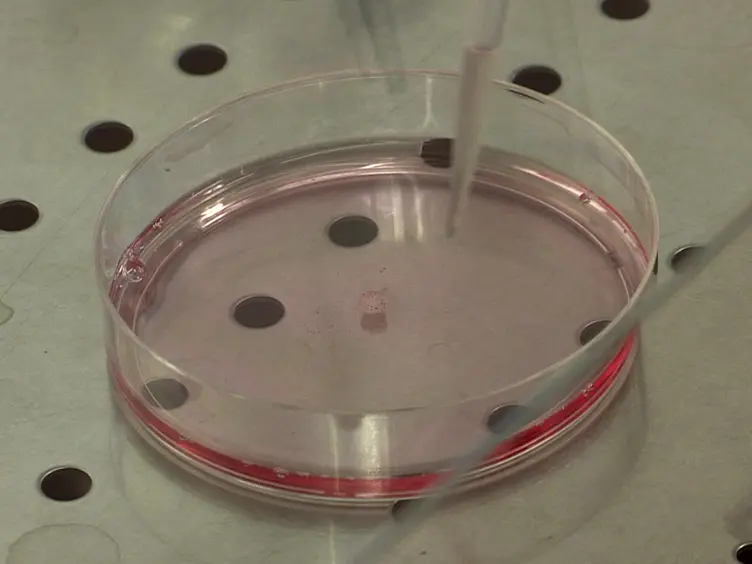 Establishment of a Human Multiple Myeloma Xenograft Model in the Chicken to Study Tumor Growth, Invasion and Angiogenesis