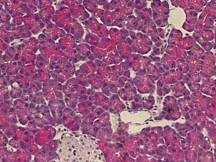 Surgical Injury to the Mouse Pancreas through Ligation of the Pancreatic Duct as a Model for Endocrine and Exocrine Reprogramming and Proliferation