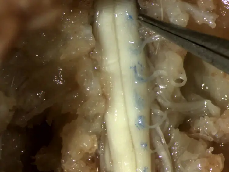 Intramuscular Injections Along the Motor End Plates: A Minimally Invasive Approach to Shuttle Tracers Directly into Motor Neurons