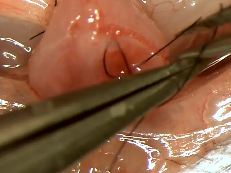 Murine Kidney Transplant Technique