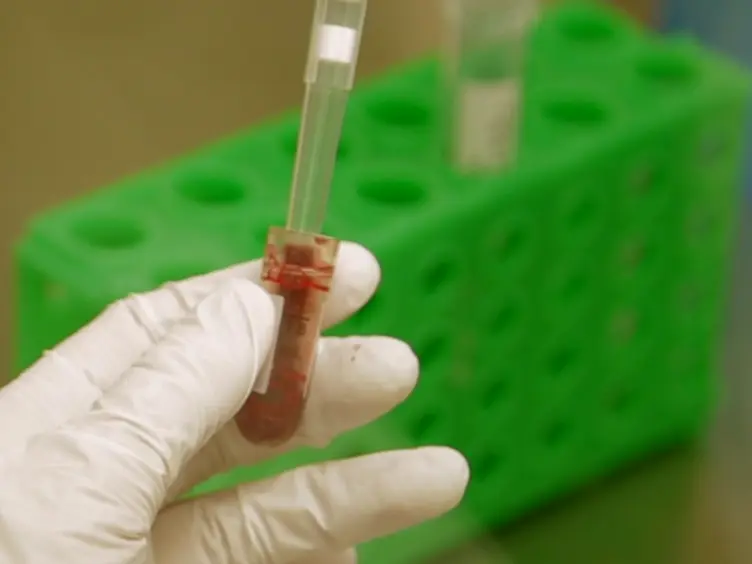 Generation of Induced Pluripotent Stem Cells from Frozen Buffy Coats using Non-integrating Episomal Plasmids