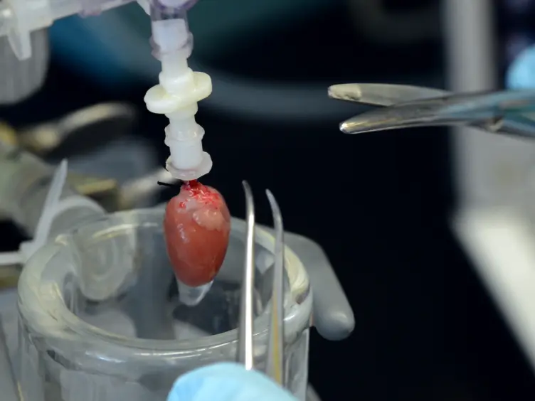 Induction and Assessment of Ischemia-reperfusion Injury in Langendorff-perfused Rat Hearts