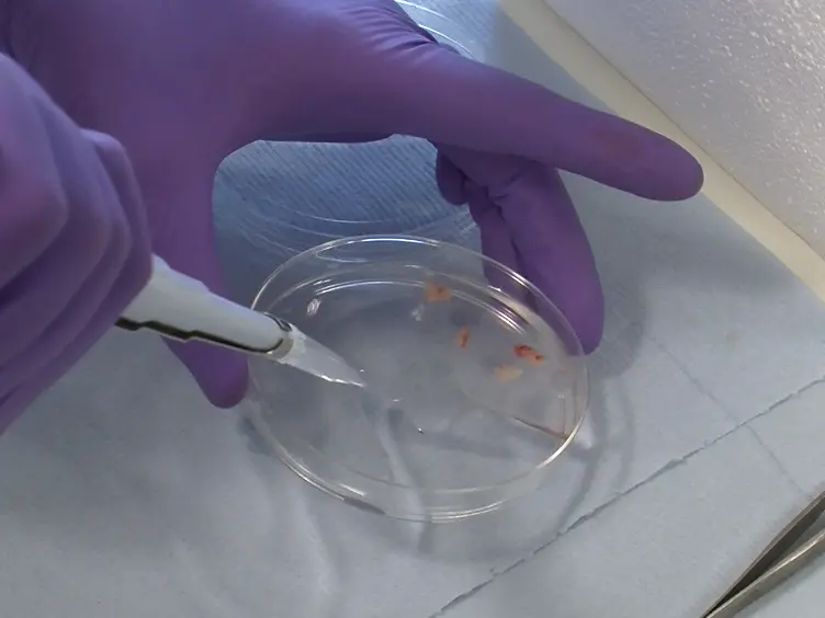 Selective Depletion of Microglia from Cerebellar Granule Cell Cultures Using L-leucine Methyl Ester