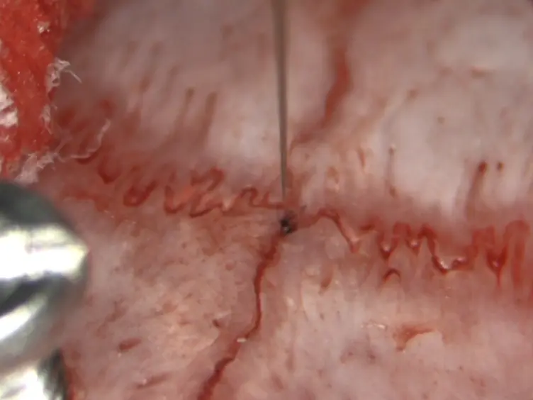 Microelectrode Guided Implantation of Electrodes into the Subthalamic Nucleus of Rats for Long-term Deep Brain Stimulation