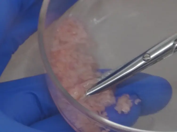 Isolation and Culture Expansion of Tumor-specific Endothelial Cells