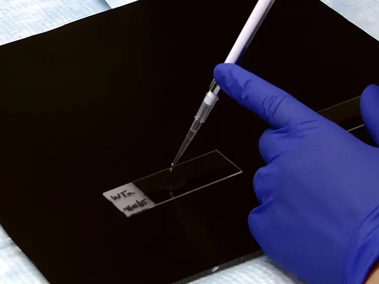 Surface Spreading and Immunostaining of Yeast Chromosomes