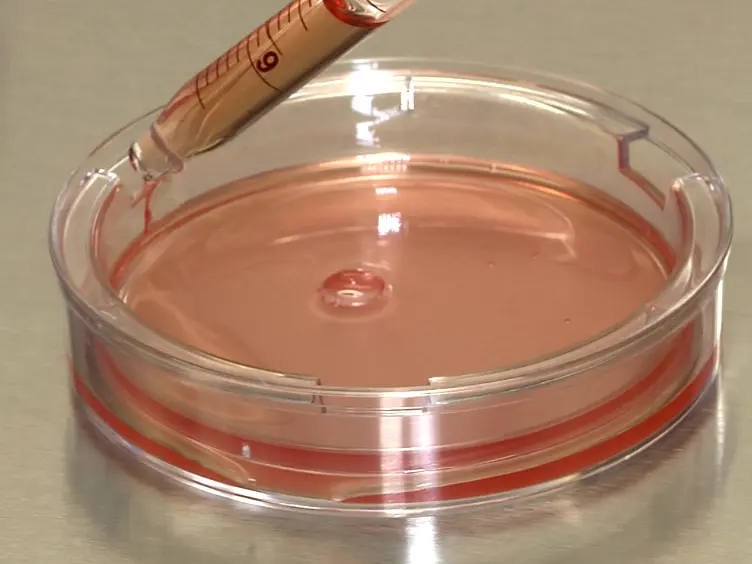 Using Caco-2 Cells to Study Lipid Transport by the Intestine