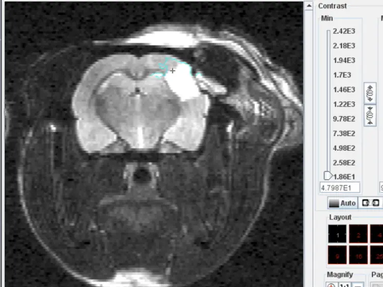 Performing Permanent Distal Middle Cerebral with Common Carotid Artery Occlusion in Aged Rats to Study Cortical Ischemia with Sustained Disability