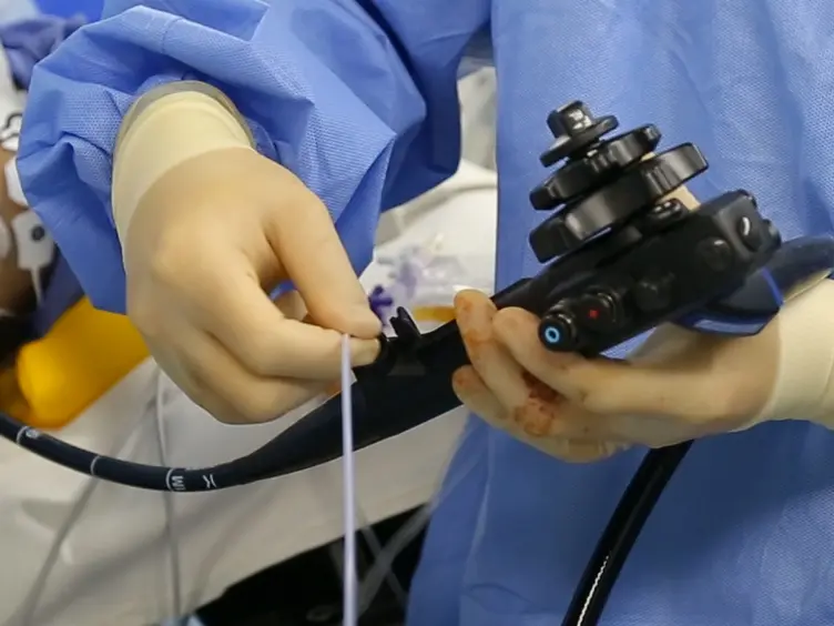 Intraoperative Gastroscopy for Tumor Localization in Laparoscopic Surgery for Gastric Adenocarcinoma