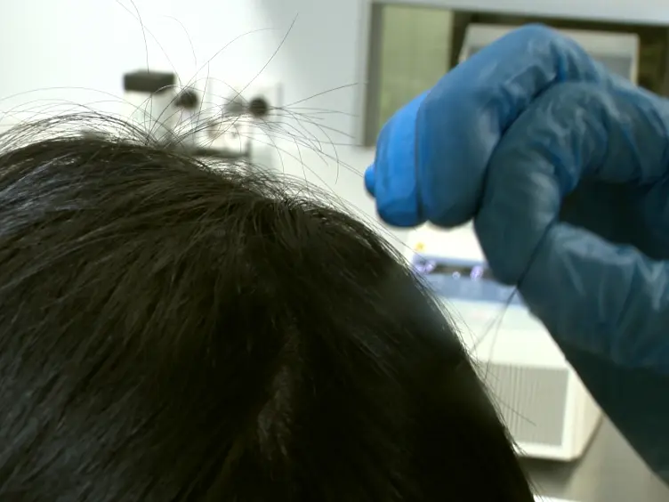 Generation of Integration-free Human Induced Pluripotent Stem Cells Using Hair-derived Keratinocytes
