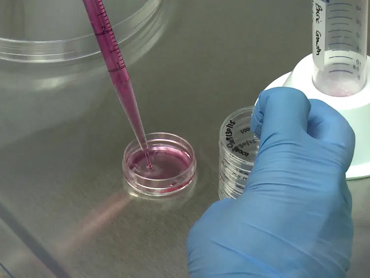 Differentiation of the SH-SY5Y Human Neuroblastoma Cell Line