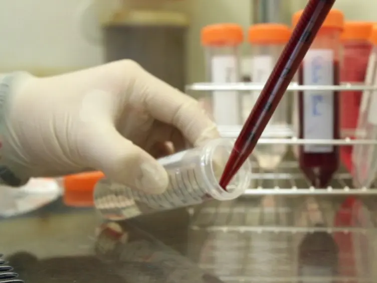Assessment of the Immunomodulatory Properties of Human Mesenchymal Stem Cells (MSCs)