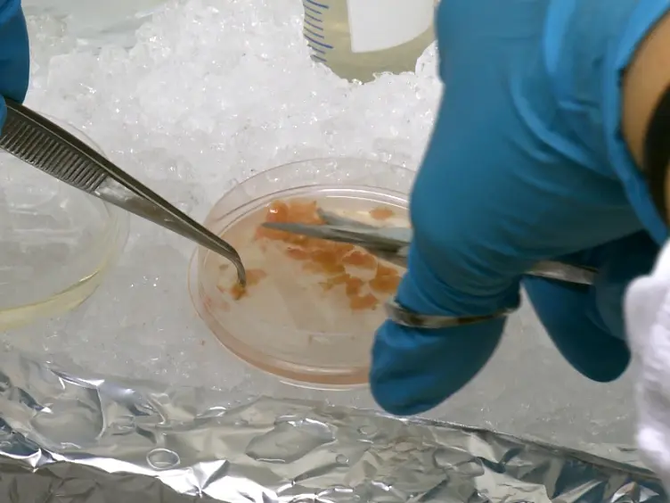 Efficient Isolation Protocol for B and T Lymphocytes from Human Palatine Tonsils