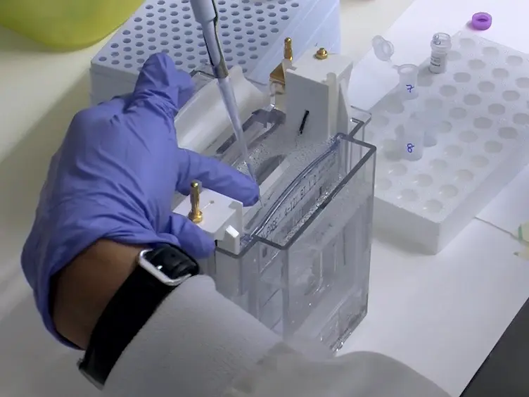 Sequential Extraction of Soluble and Insoluble Alpha-Synuclein from Parkinsonian Brains