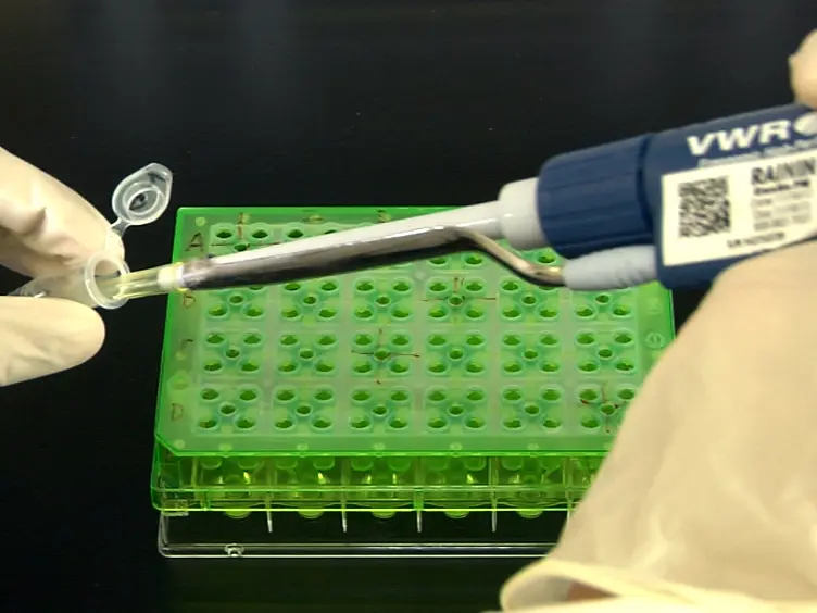 Measurement and Analysis of Extracellular Acid Production to Determine Glycolytic Rate