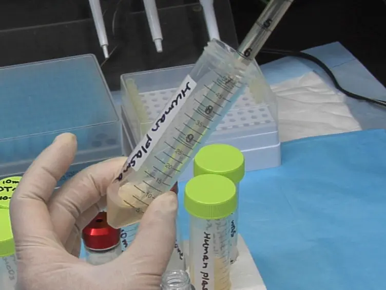 Isolation of Exosomes from the Plasma of HIV-1 Positive Individuals