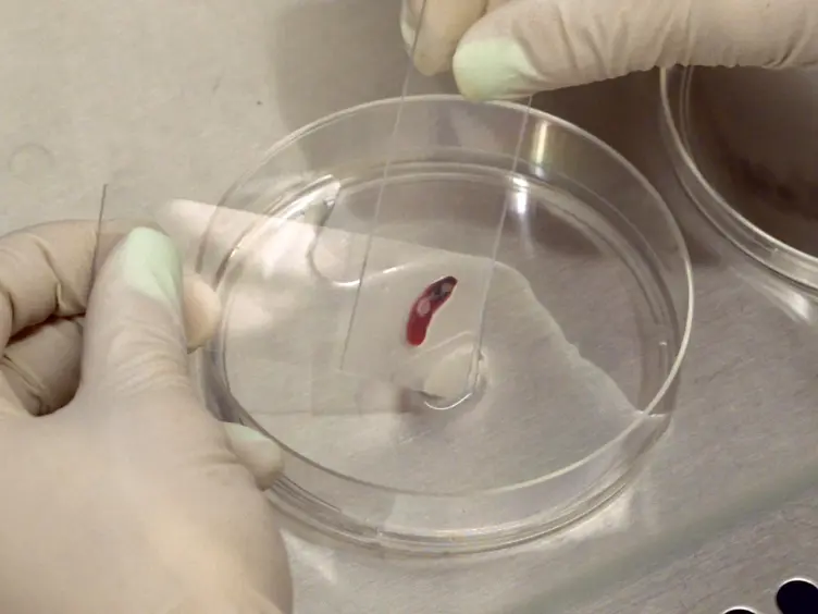 The Use of Flow Cytometry to Assess the State of Chromatin in T Cells